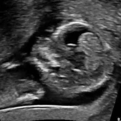 Little Beating Heart